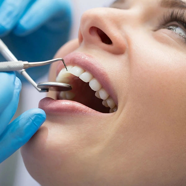 Bioemmei Azienda specializzata nell'igiene Dentale